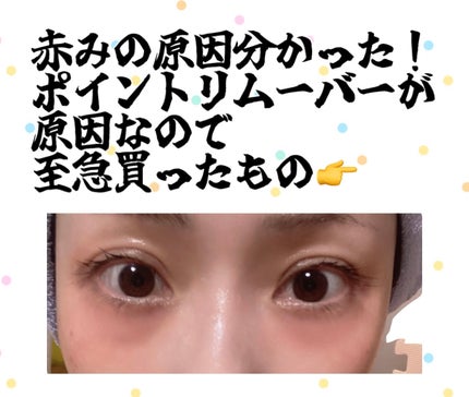 イドラビオ エイチツーオー 100ml/ビオデルマ/クレンジングウォーターを使ったクチコミ(1枚目)