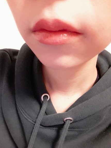 RMK カラーリップグロス/RMK/リップグロスを使ったクチコミ(4枚目)