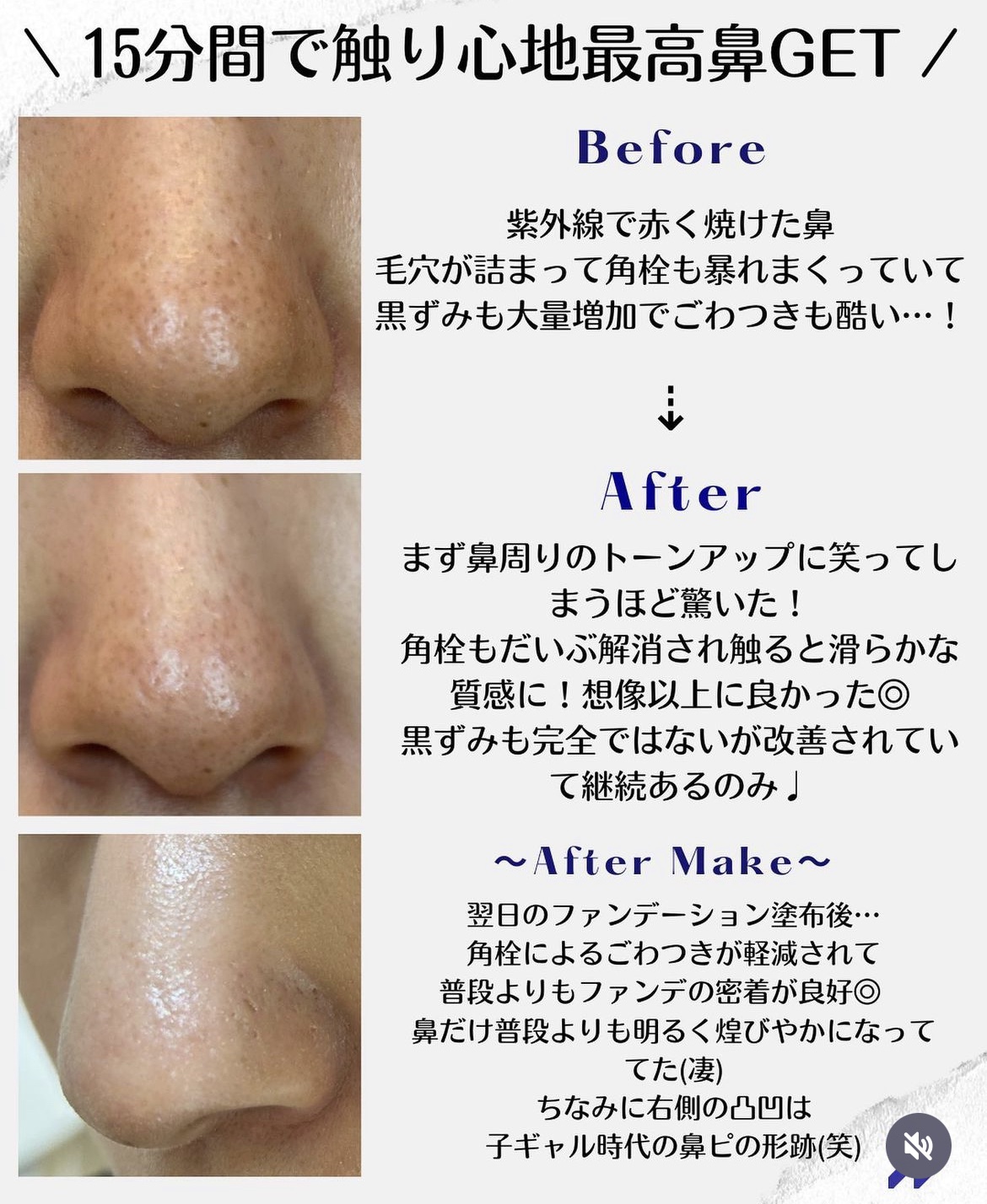 ノーズピーリングパック/One-day's you/シートマスク・パックを使ったクチコミ（3枚目）