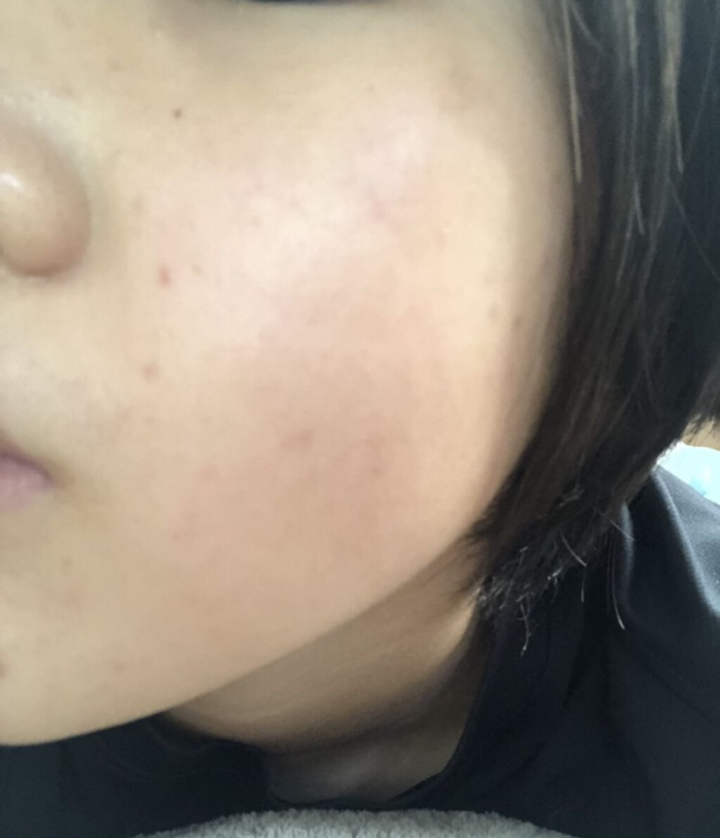 ヘルプミー! ダクトパッド/One-day's you/トナーパッドを使ったクチコミ（3枚目）