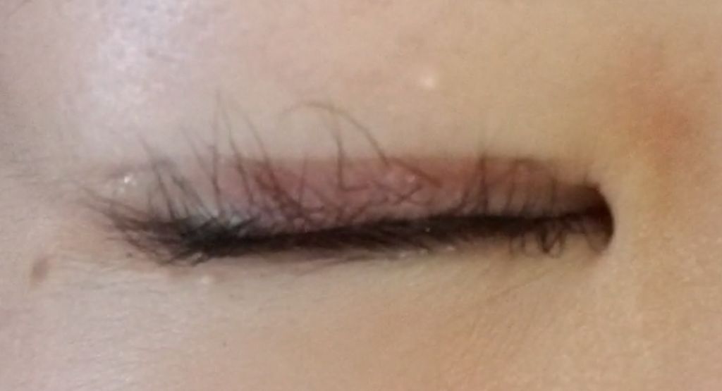 アイビューティー フィクサー WP/アストレア ヴィルゴ/二重まぶた用アイテムを使ったクチコミ(3枚目)