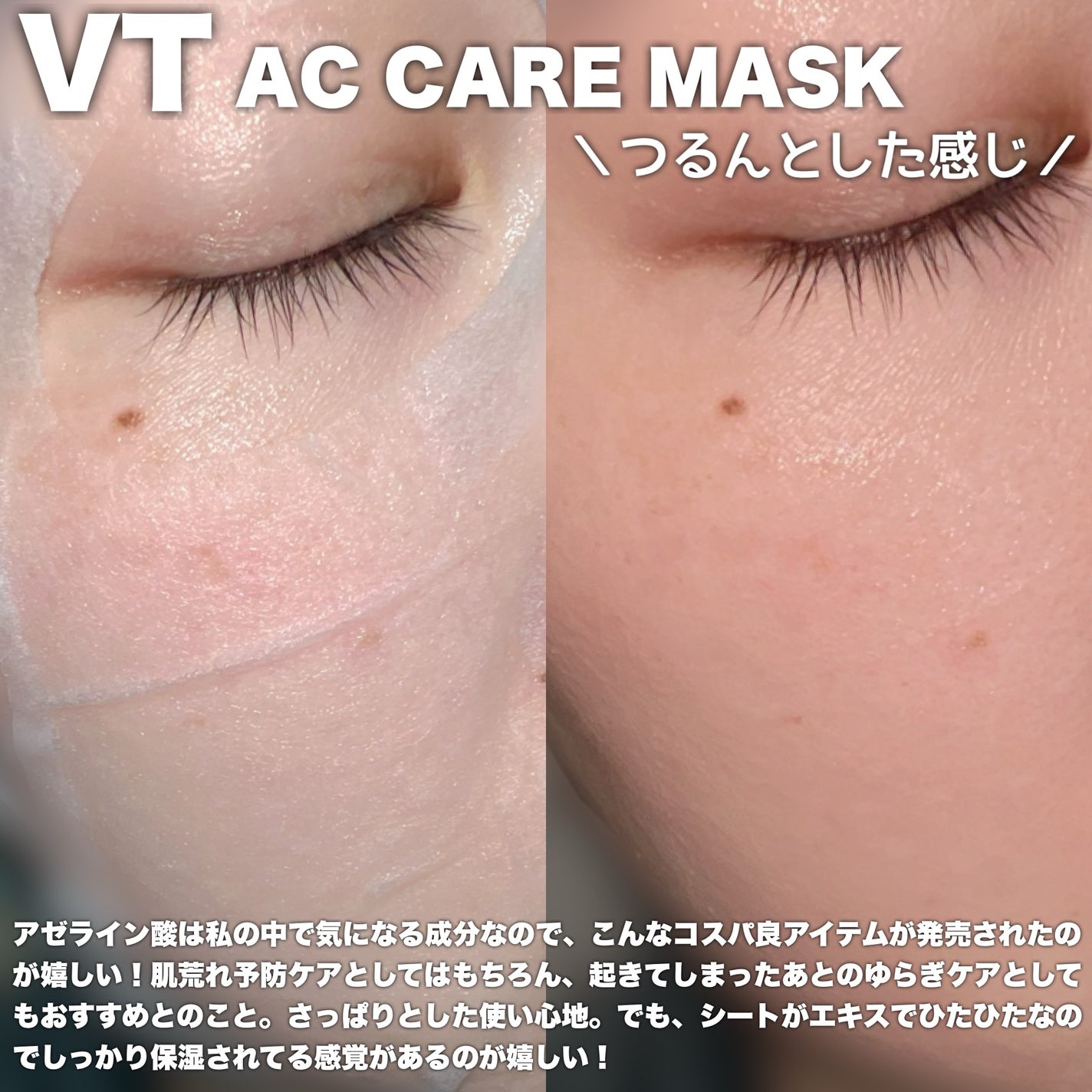 AZケア マスク/VT/シートマスク・パックを使ったクチコミ(4枚目)