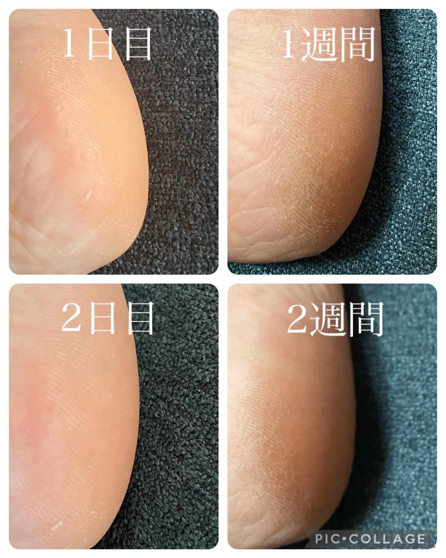 カカトリーヌモイストローション/KAKATOrine/レッグ・フットケアを使ったクチコミ(2枚目)