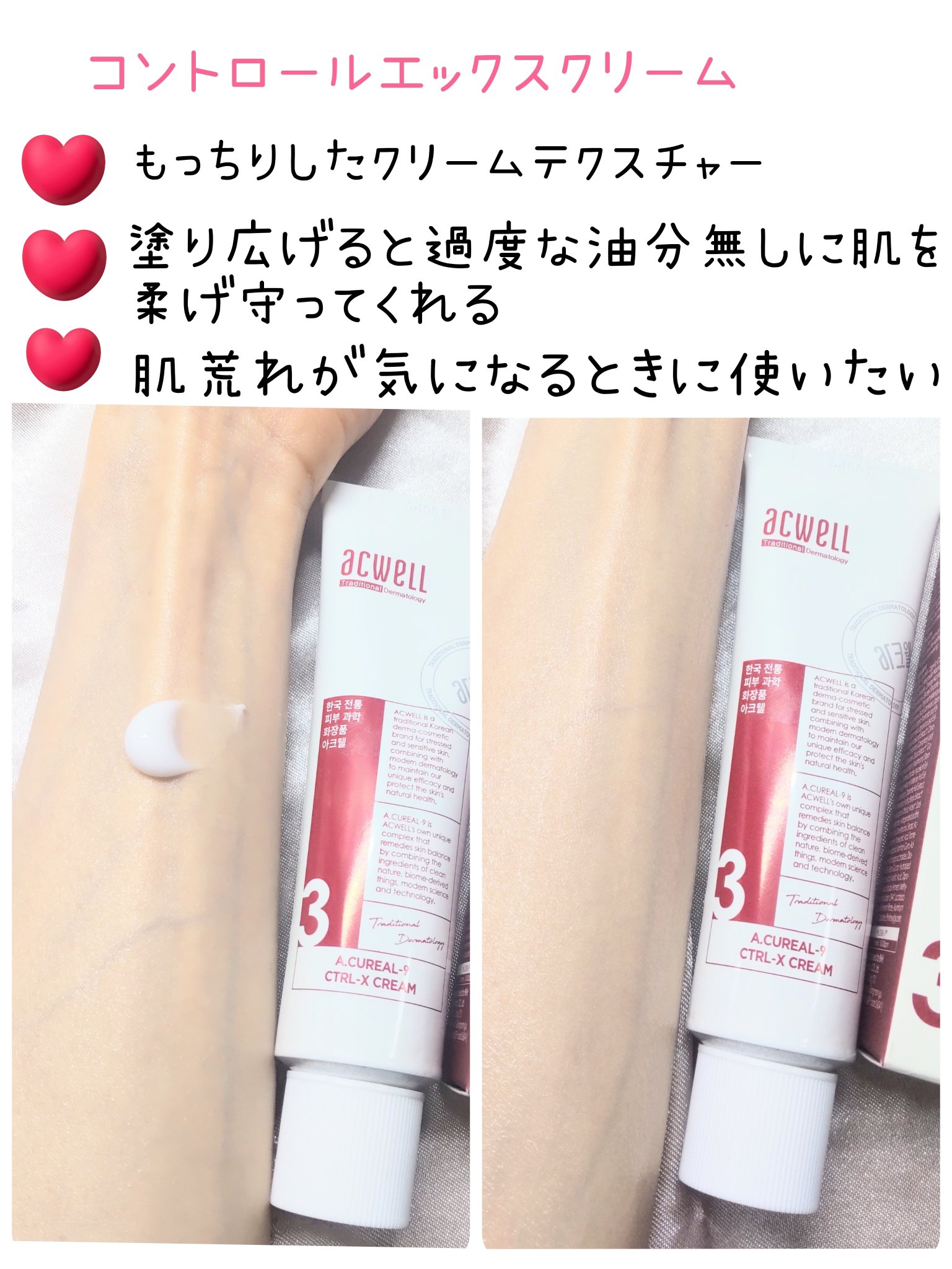 アキュリアルナインコントロールエックスクリーム/ACWELL/フェイスクリームを使ったクチコミ（3枚目）