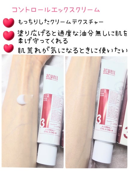 アキュリアルナインコントロールエックスクリーム/ACWELL/フェイスクリームを使ったクチコミ(3枚目)