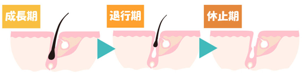 shinasaka 脱毛器 光美容器/shinasaka/家庭用脱毛器を使ったクチコミ（1枚目）