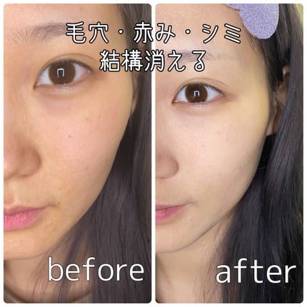 ドクタージャルト シカペア リカバー (第2世代)/Dr.Jart+/フェイスクリームを使ったクチコミ(3枚目)