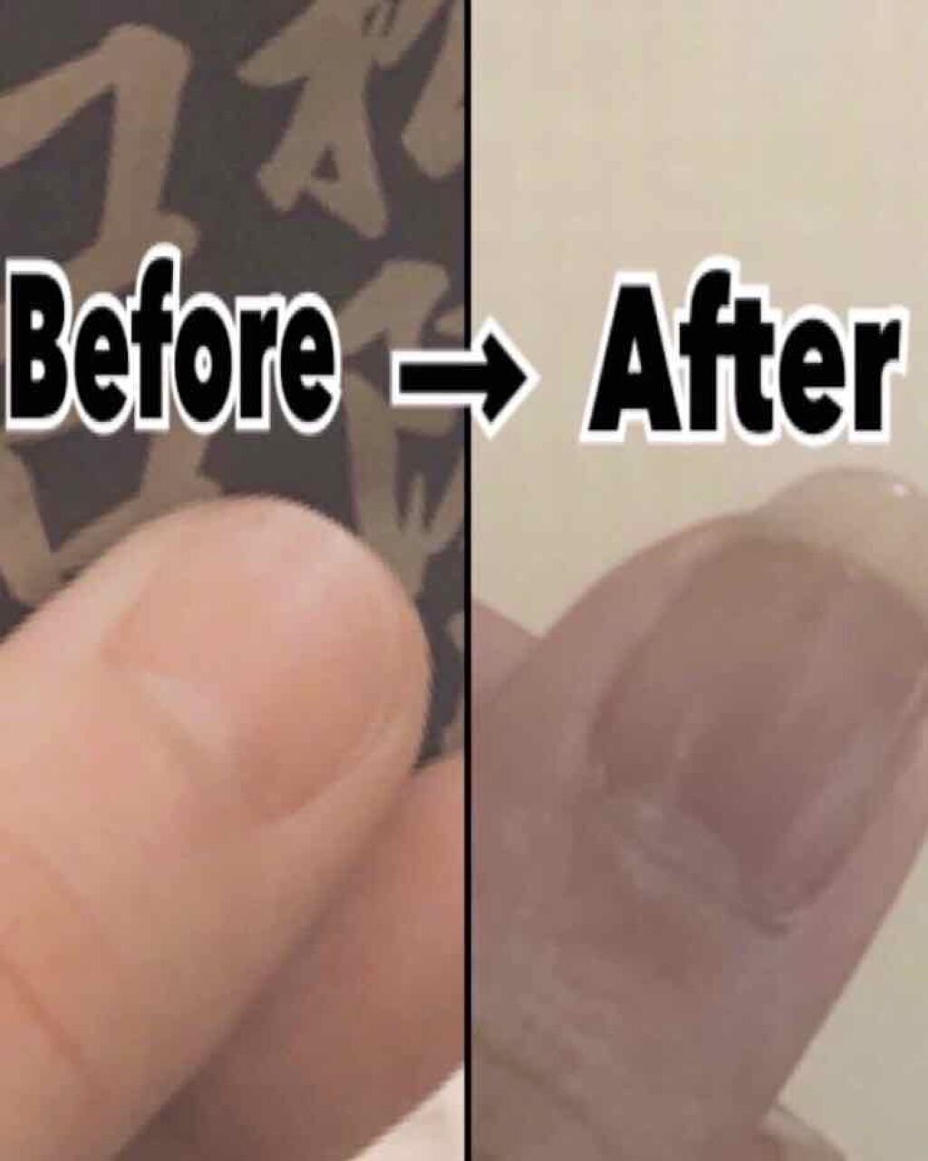 エテュセ クイックケアコート/ettusais/ネイルオイル・トリートメントを使ったクチコミ（2枚目）