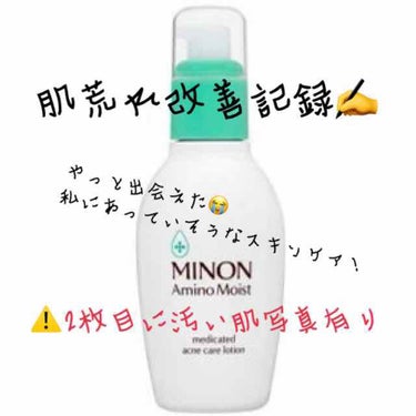 精製水（医薬品）/健栄製薬/その他を使ったクチコミ（1枚目）