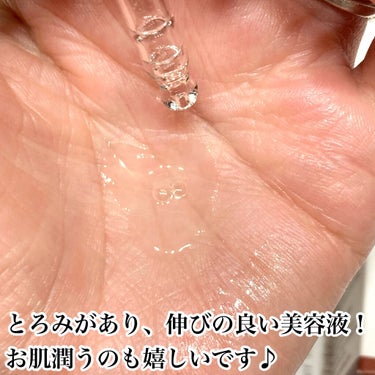 コスデバハ AZセラムのクチコミ「\ニキビや赤ら顔に/


治療薬として使用されている成分
"アゼライン酸"を10%配合した美容.....」（2枚目）