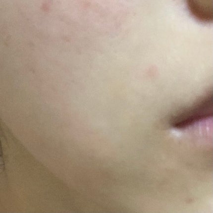 薬用しみ集中対策 プレミアム美容液/メラノCC/美容液を使ったクチコミ(7枚目)