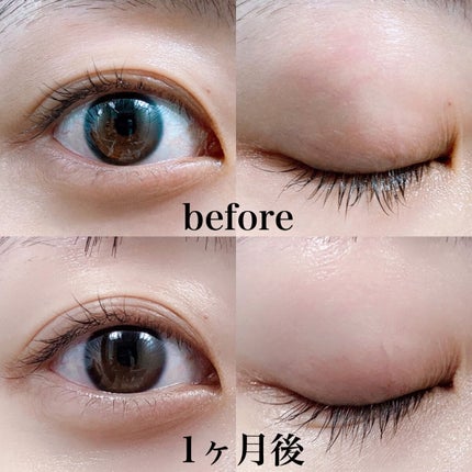 アイラッシュセラム/ビヴェール/まつげ美容液を使ったクチコミ(6枚目)