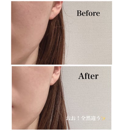 ピーリングパッド ポアノ/ウツクシア/トナーパッドを使ったクチコミ(5枚目)