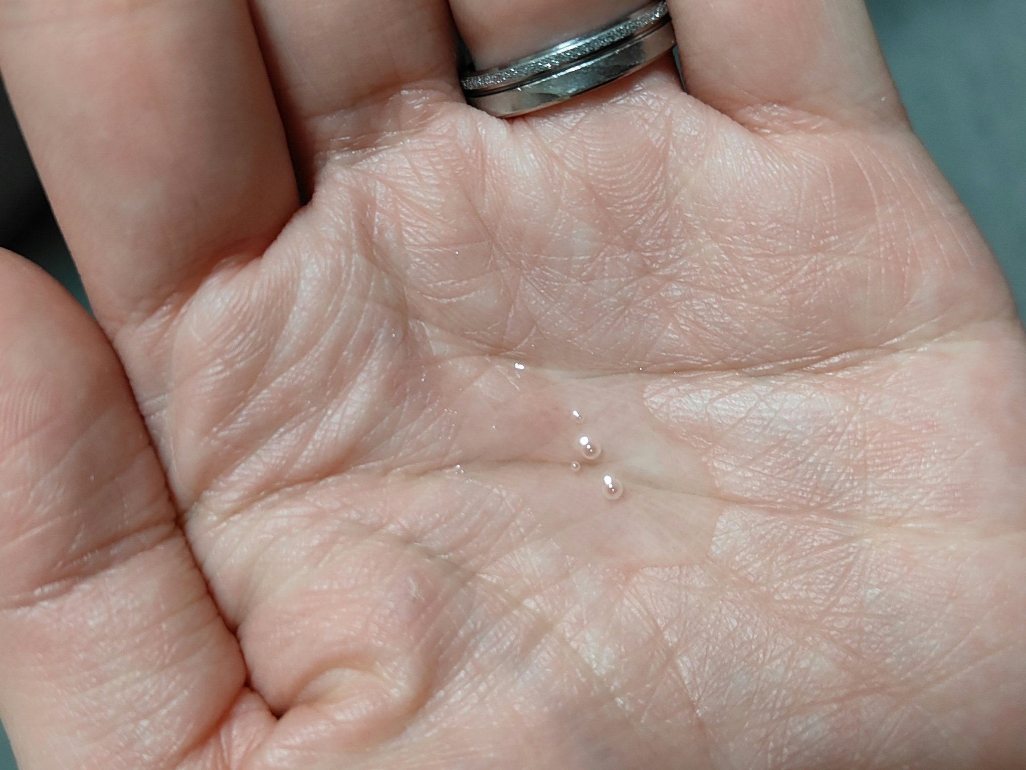 乾燥さん　薬用しっとり化粧液【医薬部外品】/乾燥さん/オールインワン化粧品を使ったクチコミ（2枚目）