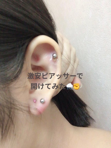 オロナインH軟膏 (医薬品)/オロナイン/その他を使ったクチコミ(1枚目)