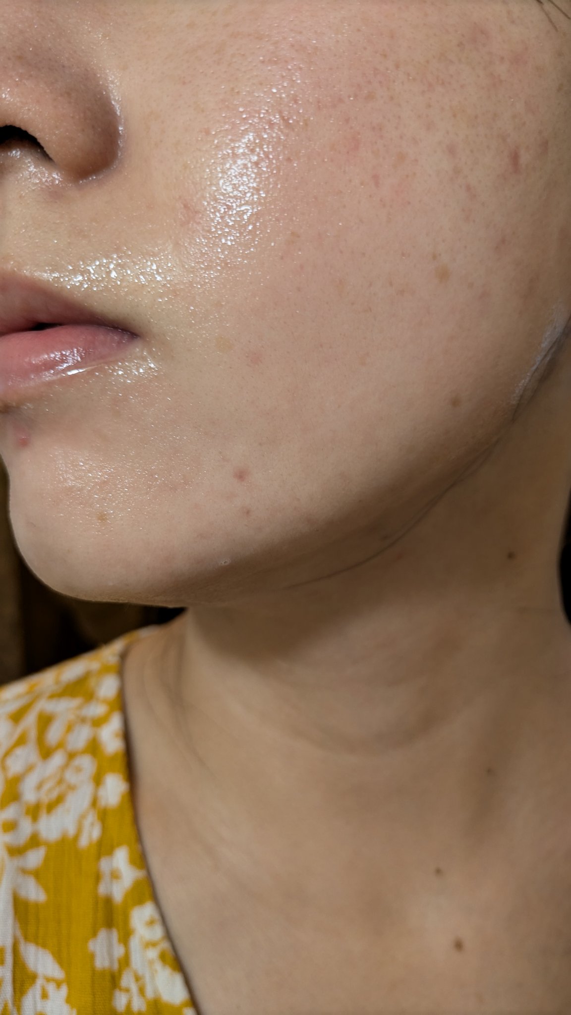 クリーム NC/なめらか本舗/フェイスクリームを使ったクチコミ（2枚目）