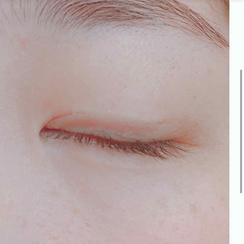 アイトーク/アイトーク/二重まぶた用アイテムを使ったクチコミ(2枚目)