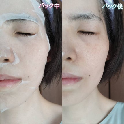 キューブマスク プロポリス/ネイチャーリパブリック/シートマスク・パックを使ったクチコミ(10枚目)