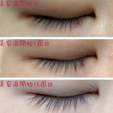 アイラッシュセラム Phoebe Beauty Upの効果に関する口コミ ご覧下さりありがとうございます 今回から By Ayumi 0 混合肌 30代前半 Lips