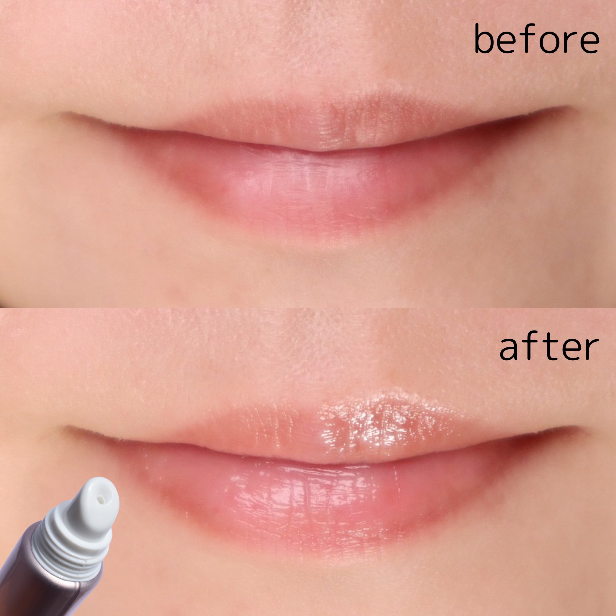 ナイトニードルリップ/CHOOSY/リップ美容液を使ったクチコミ（3枚目）