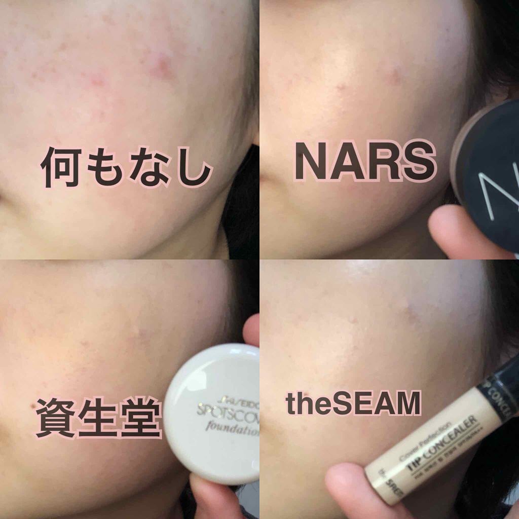 スポッツカバー ファウンデイション/SHISEIDO/クリームコンシーラーを使ったクチコミ(3枚目)