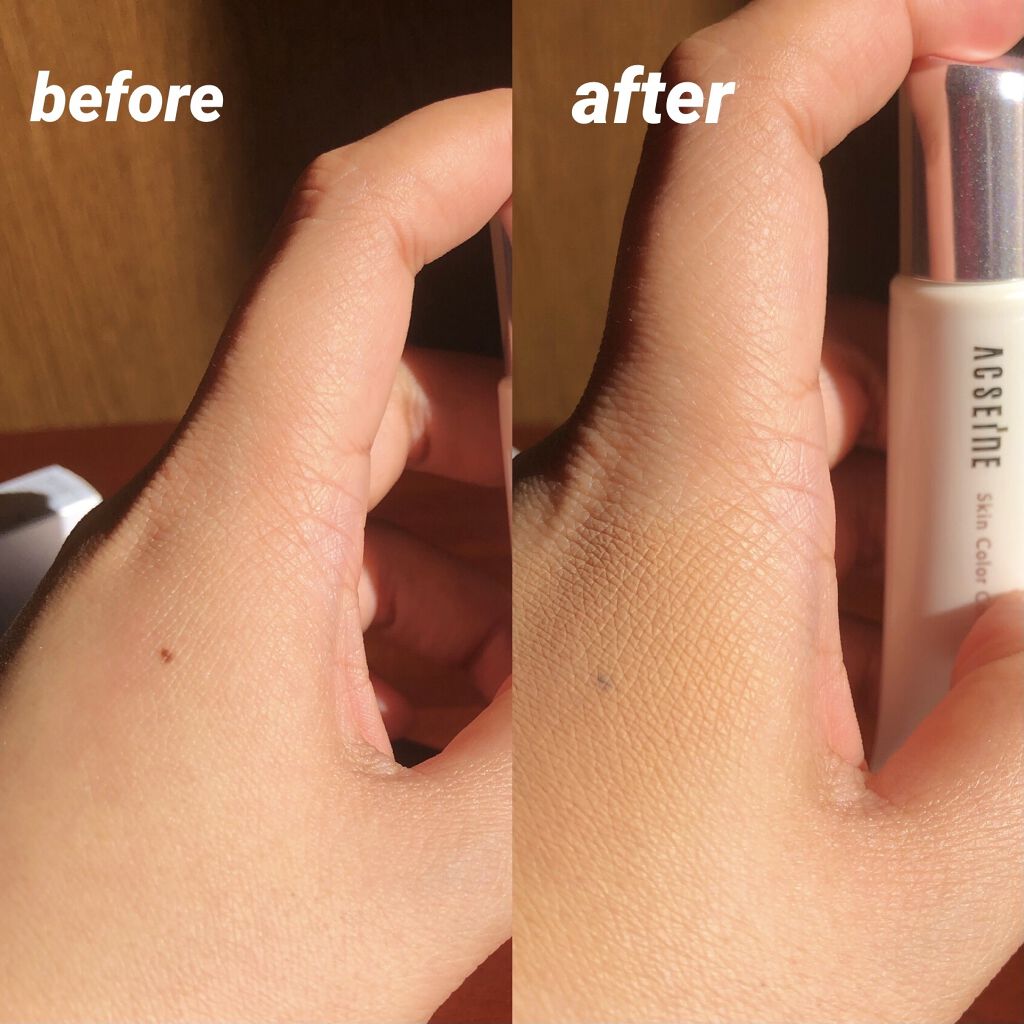 スキンカラーコントロール/ACSEINE/クリームコンシーラーを使ったクチコミ（3枚目）