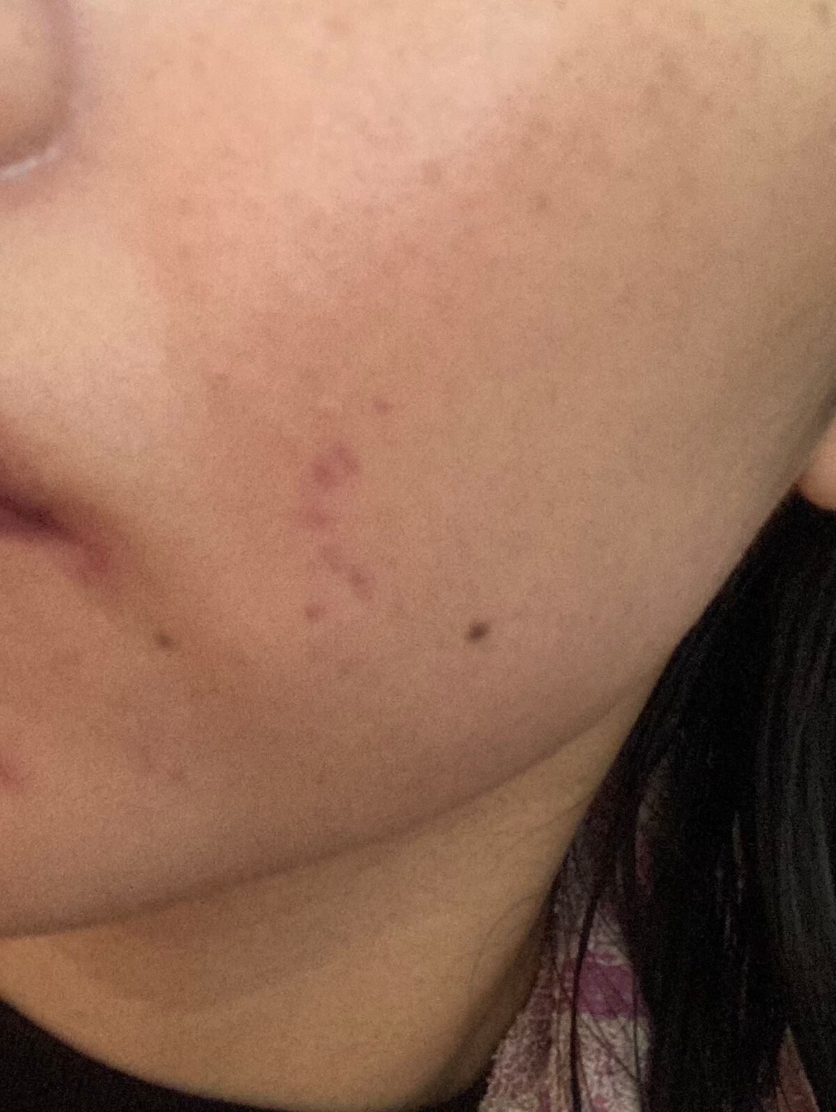 タトゥーウォータープルーフスカーコンシーラー/フォレンコス/リキッドコンシーラーを使ったクチコミ(3枚目)