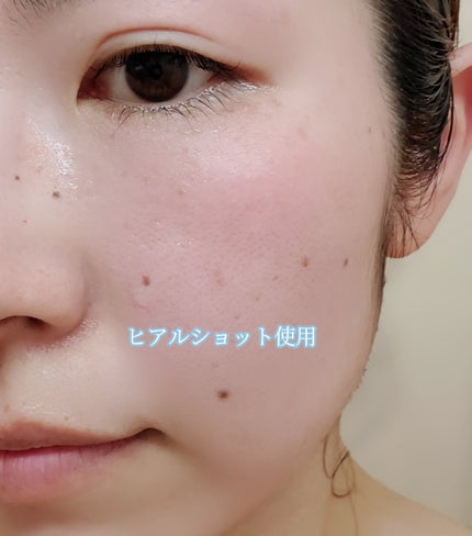 RTXセラム ビタミンショット/Dr.G/美容液を使ったクチコミ(8枚目)