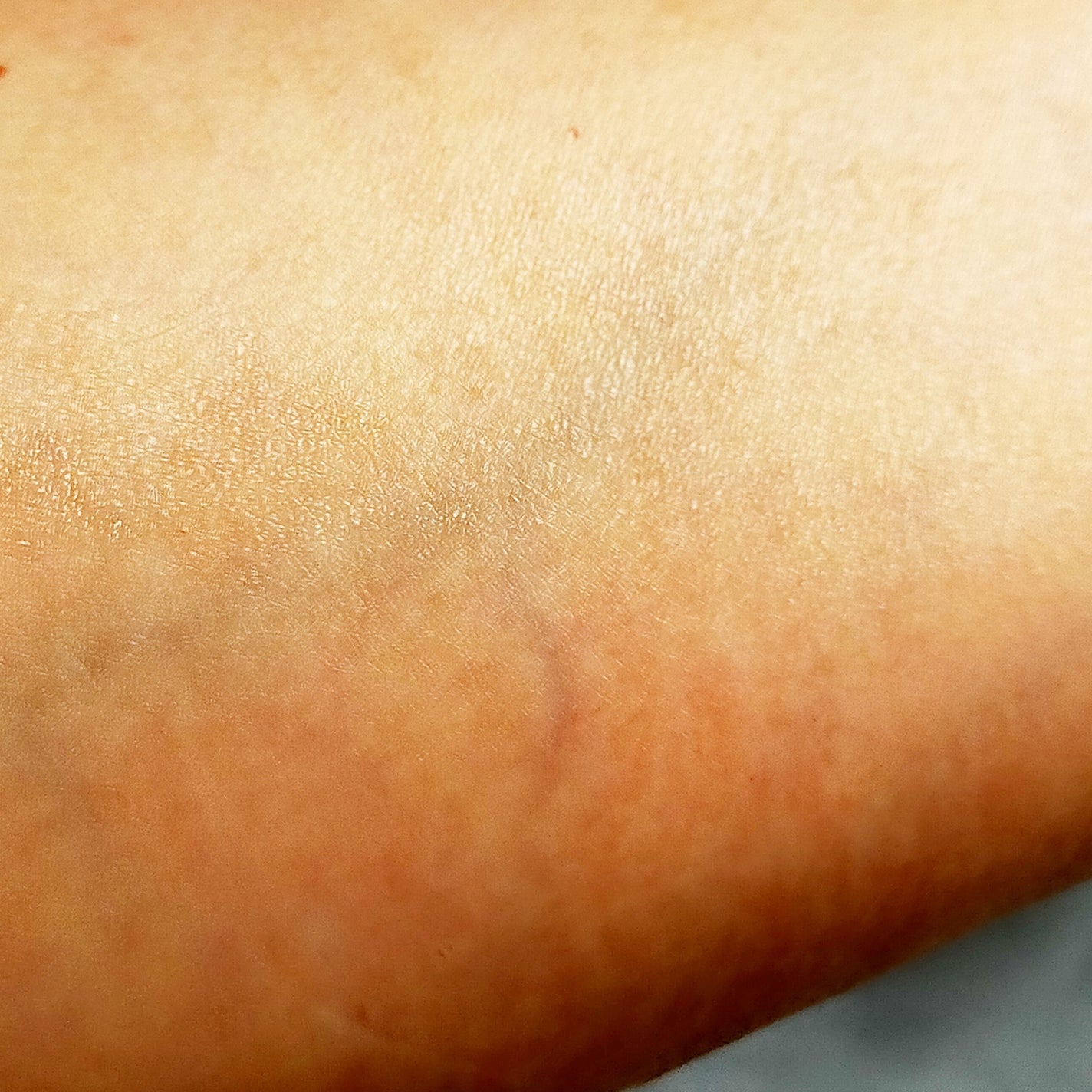 カプセルセラム CPセラム G 美容液/カプセルセラム/美容液を使ったクチコミ(5枚目)