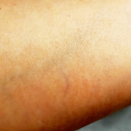 カプセルセラム CPセラム G 美容液/カプセルセラム/美容液を使ったクチコミ(5枚目)