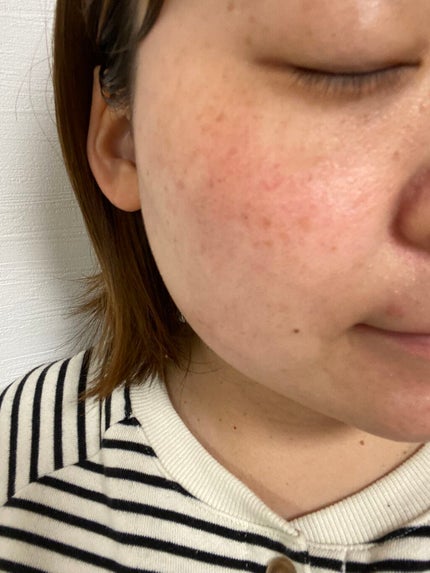 リベクス シーフラン キャビア リフトマスクBA2/RIBECS/シートマスク・パックを使ったクチコミ(5枚目)