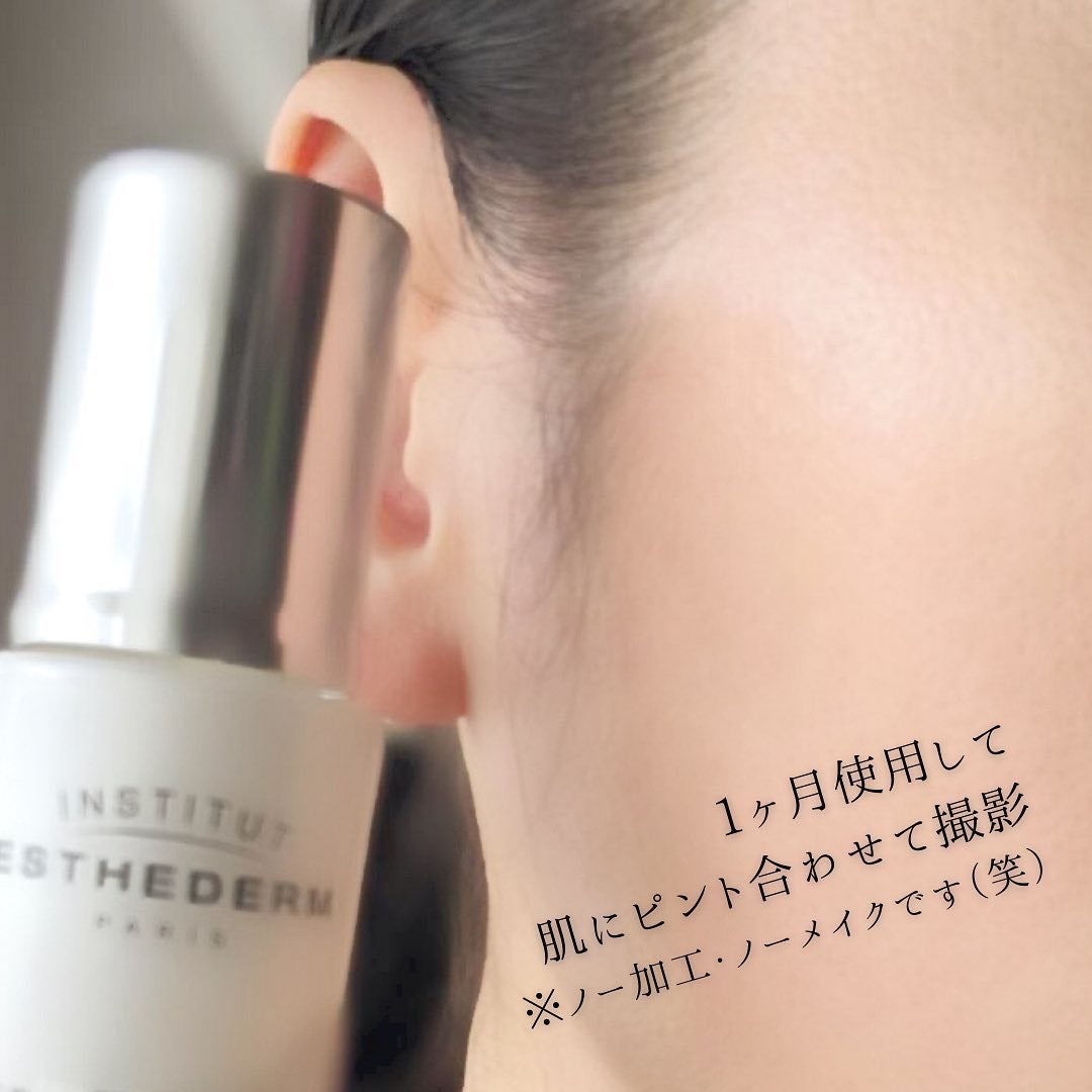 エージプロテオム/エステダム/美容液を使ったクチコミ(8枚目)