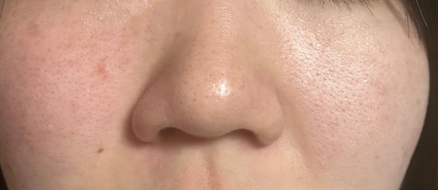 菊正宗 日本酒の化粧水 高保湿/菊正宗/化粧水を使ったクチコミ(2枚目)