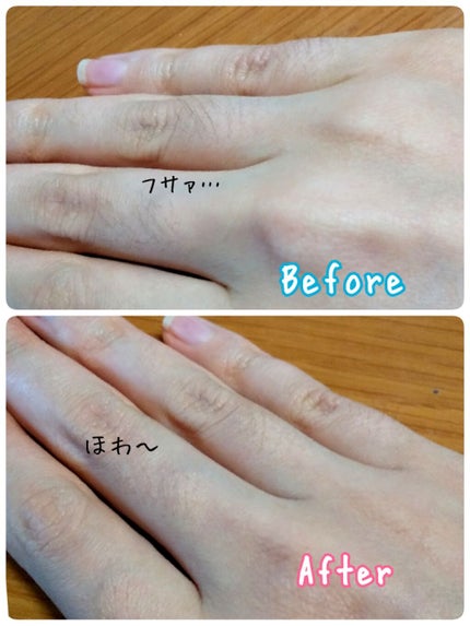 脱色クリーム 敏感肌用/エピラット/ムダ毛ケアを使ったクチコミ(2枚目)