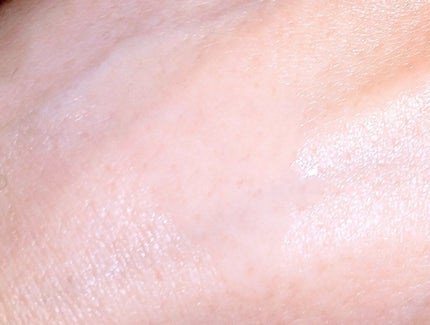 ネイチャーコンク 薬用クリアローション/ネイチャーコンク/拭き取り化粧水を使ったクチコミ(3枚目)