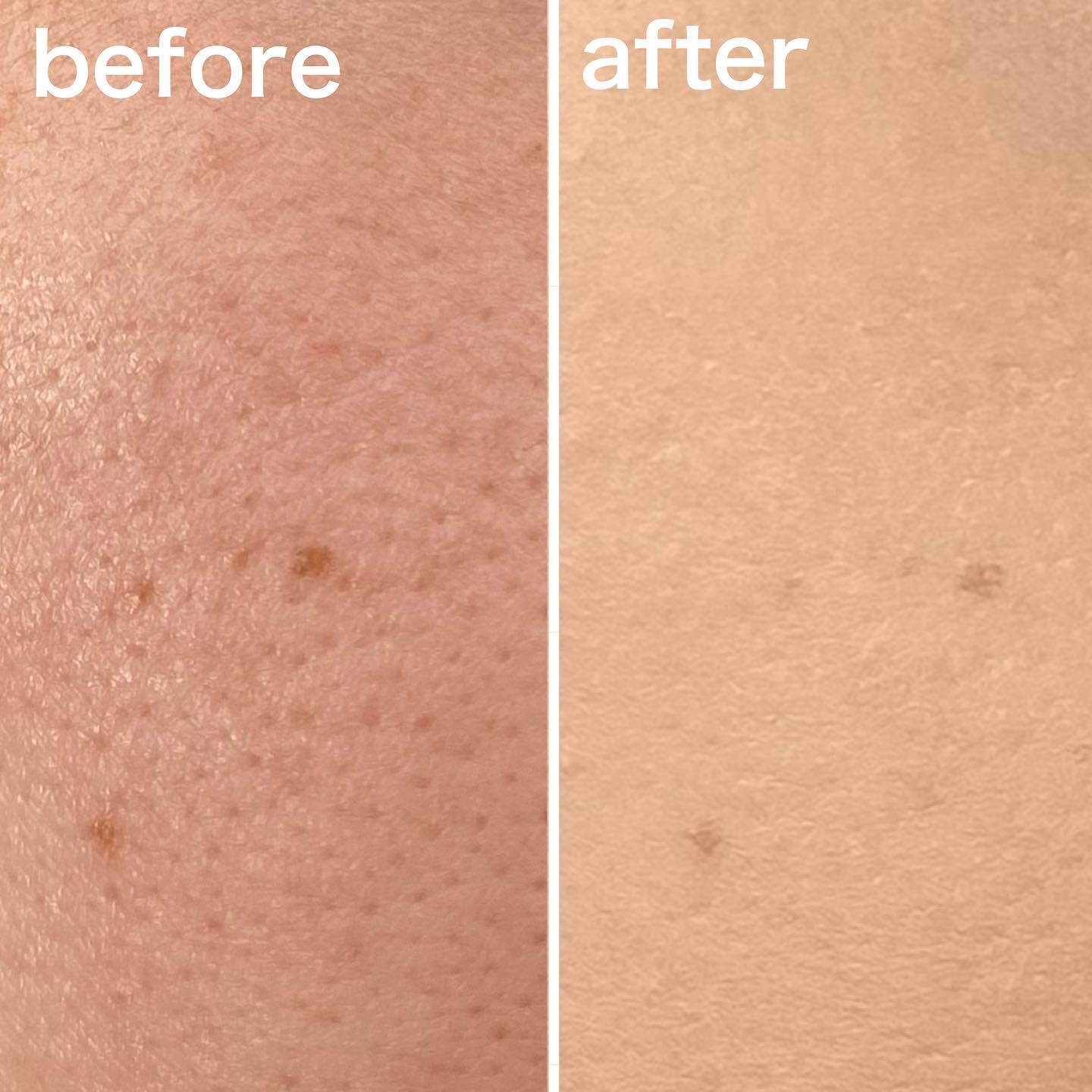 リールカバーシカクッション/MERYTHOD/クッションファンデーションを使ったクチコミ（3枚目）