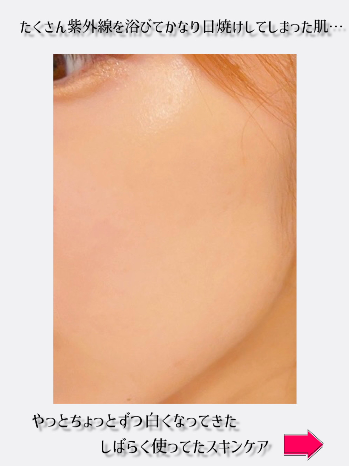 白潤プレミアム 薬用浸透美白乳液/肌ラボ/乳液を使ったクチコミ（2枚目）