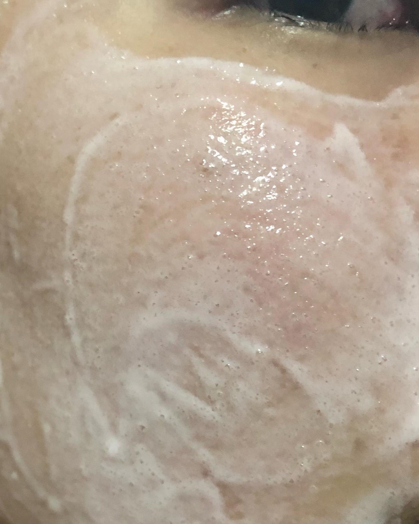 ピンクティーツリーライスシカウォッシュオフパック/APLIN/洗い流すパック・マスクを使ったクチコミ(7枚目)