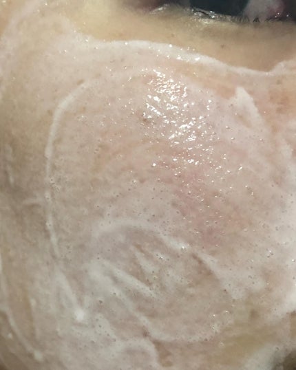 ピンクティーツリーライスシカウォッシュオフパック/APLIN/洗い流すパック・マスクを使ったクチコミ(7枚目)