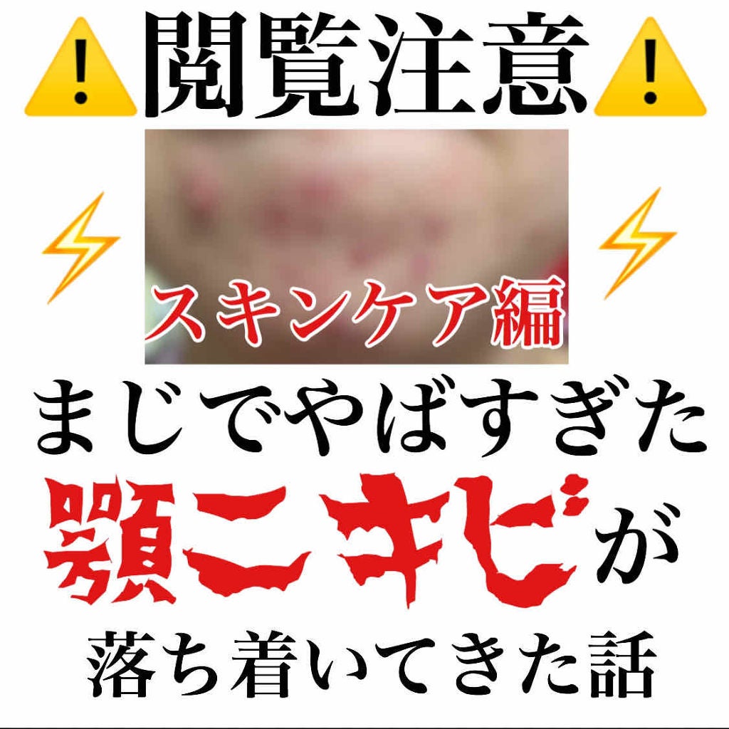 7 day Special Set プログラム3/b.glen/トライアルキットを使ったクチコミ(1枚目)