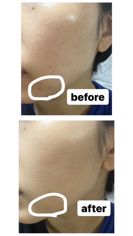 プロテーラービーベルベットカバークッション/espoir/クッションファンデーションを使ったクチコミ(2枚目)