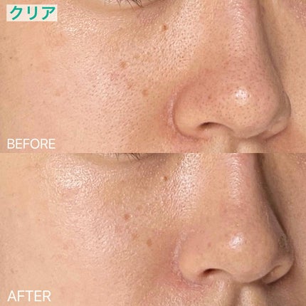 UVイデア XL プロテクショントーンアップ ローズ/ラ ロッシュ ポゼ/日焼け止めクリームを使ったクチコミ(5枚目)