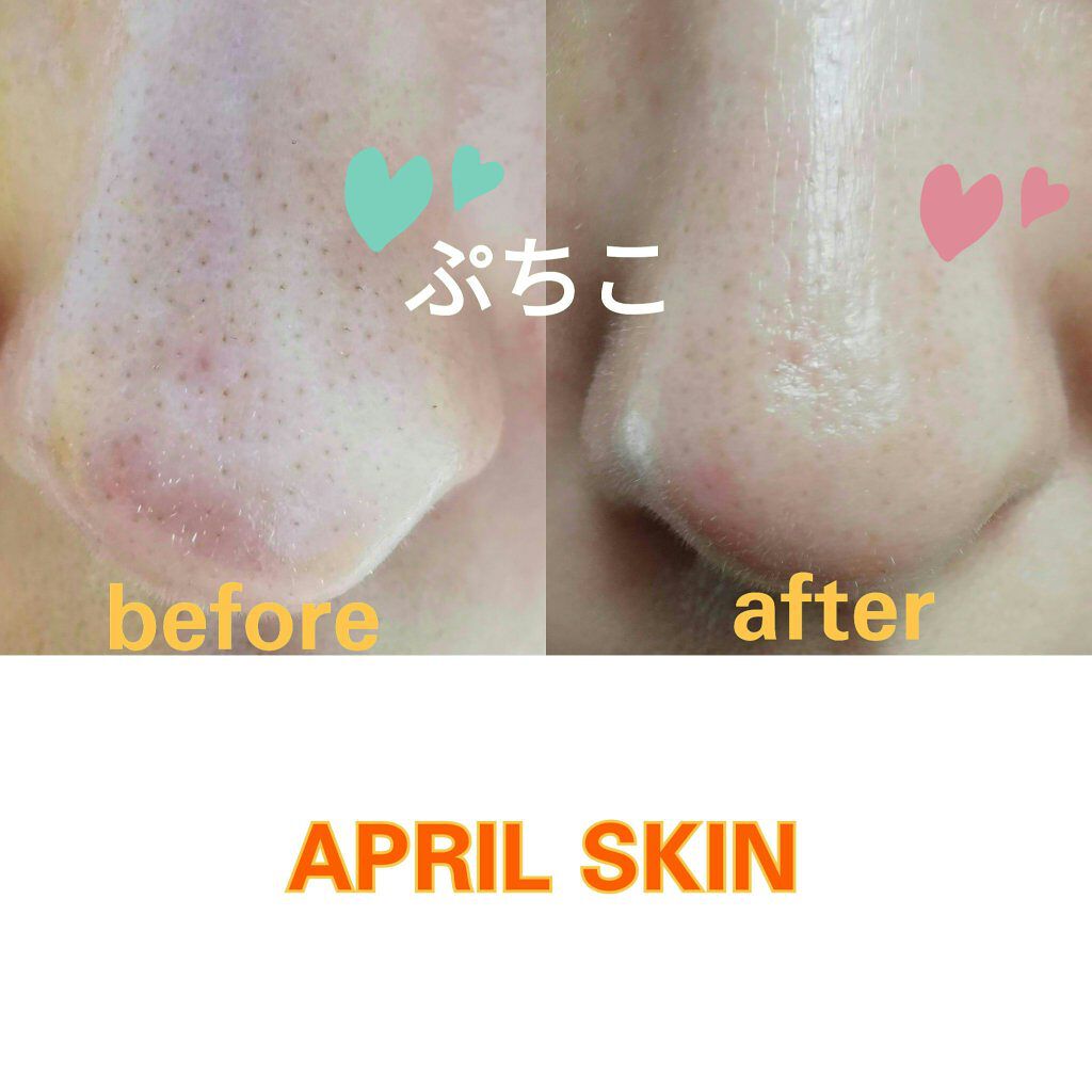 リアルカレンデュラピールオフパック/APRILSKIN/ピーリングを使ったクチコミ(2枚目)