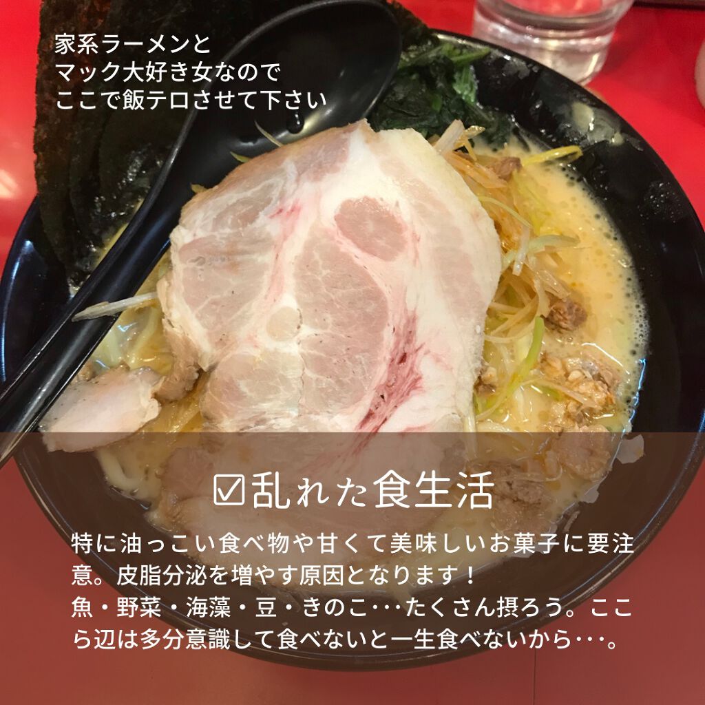 HPローション(医薬品)/ノバルティス ファーマ/その他を使ったクチコミ(8枚目)