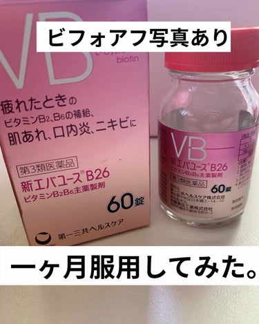 エバユース 新エバユースＢ26 (医薬品)のクチコミ「私的になかなかの効果…！
年中ニキビ肌なのでずっと服用し続けたいサプリ。

※もちろん人それぞ.....」（1枚目）