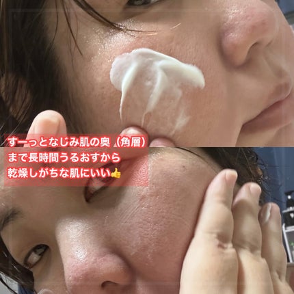 シカルファットプラス リペアクリーム/アベンヌ/フェイスクリームを使ったクチコミ(2枚目)