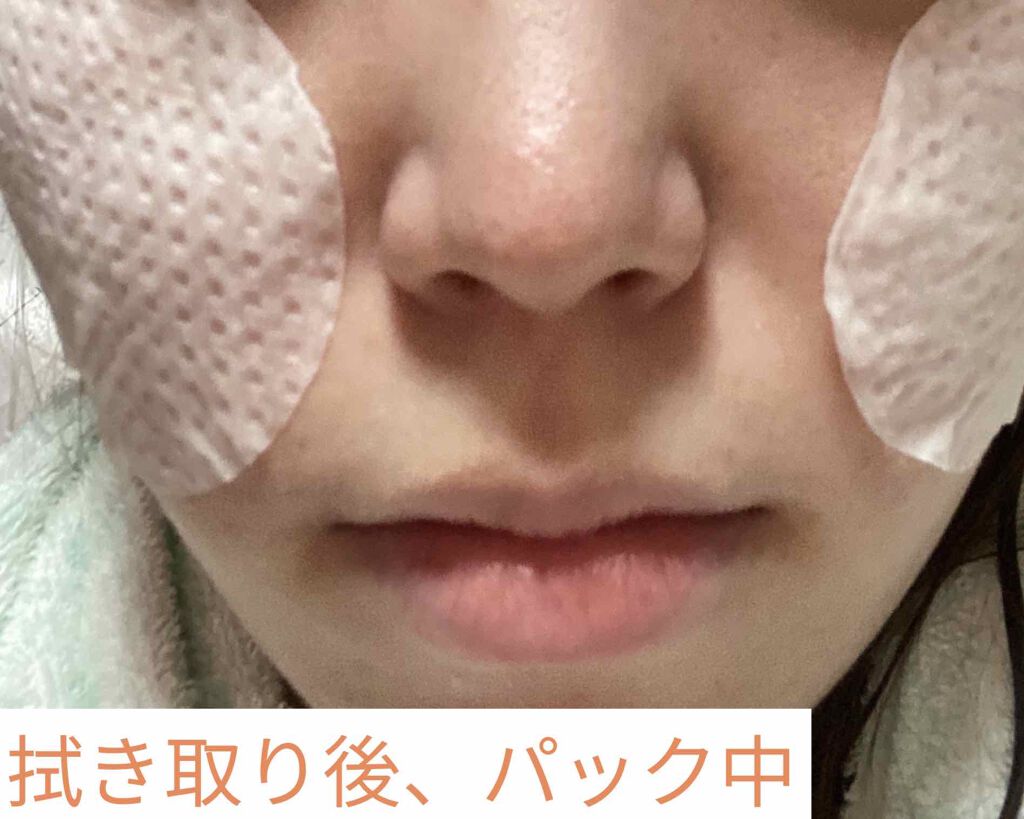 キャロットカロテン カーミングウォーターパッド/SKINFOOD/トナーパッドを使ったクチコミ(4枚目)