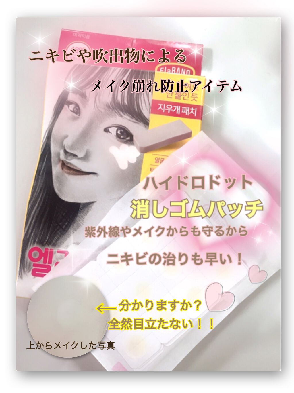 エラバンドパッチ/ElaBAND/その他を使ったクチコミ(1枚目)