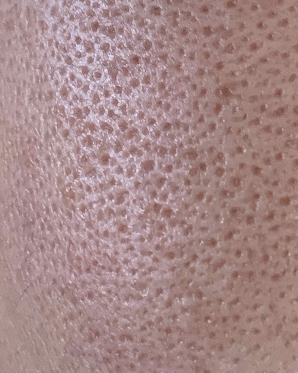 きの on LIPS 「初めての投稿です。無加工写真、2枚目閲覧注意です😭アドバイスい..」(2枚目)