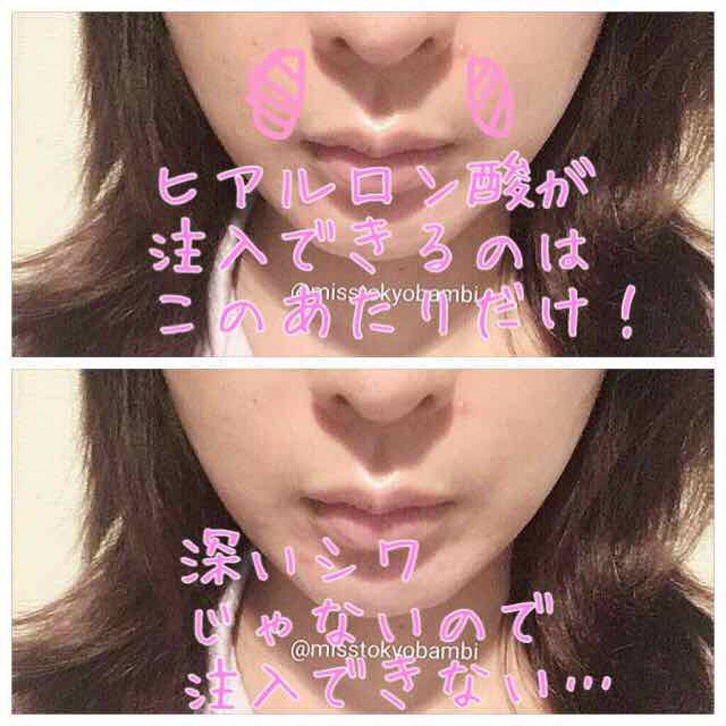 品川スキンクリニック/ノーブランド/その他を使ったクチコミ（3枚目）